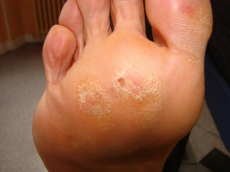 Ballerine avant pied 4