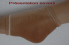 Chevillre de protection pour la prvention des escarres talon/malloles 3